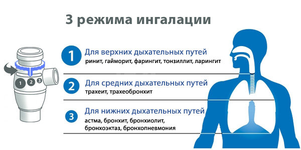 Ингаляции при трахеите. Средство от воспаления легких и дыхательных путей. Какое масло надо в ингалятор для верхних дыхательных путей для детей. Можно ли делать паровые ингаляции при трахеите. Над чем можно подышать при насморке.